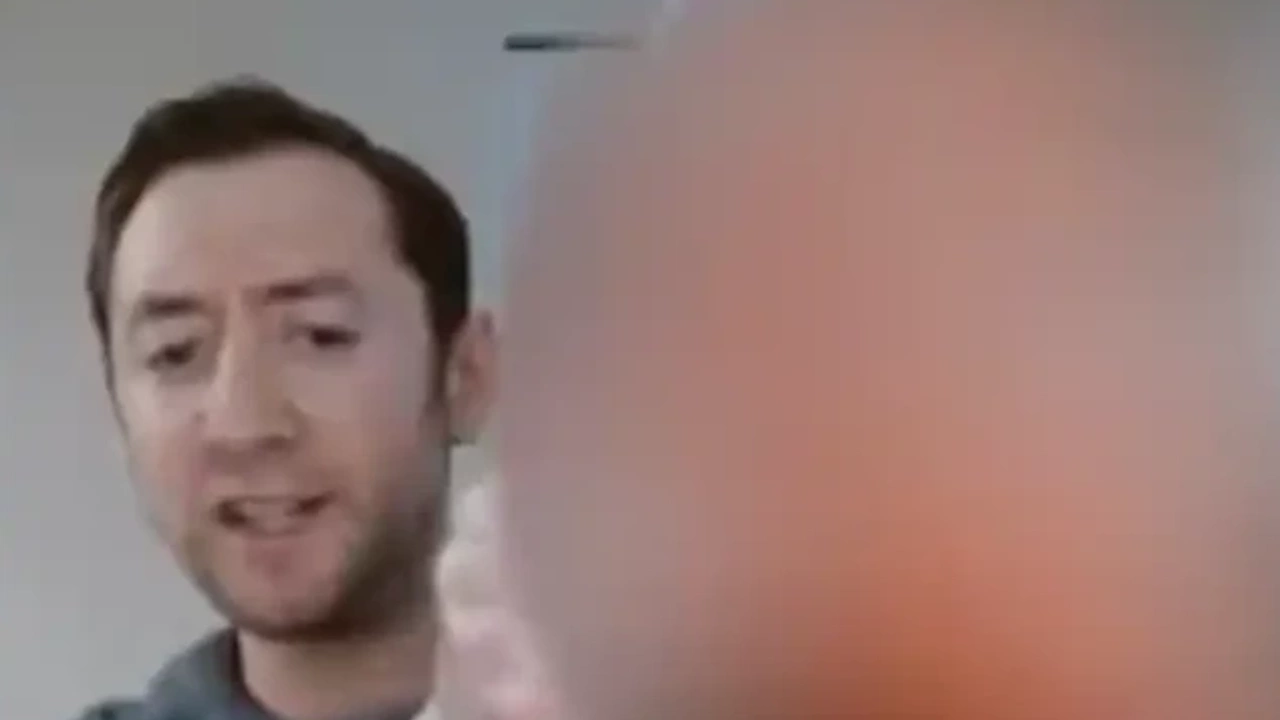 Abd Kesik Bas Sosyal Medya 31012024 1