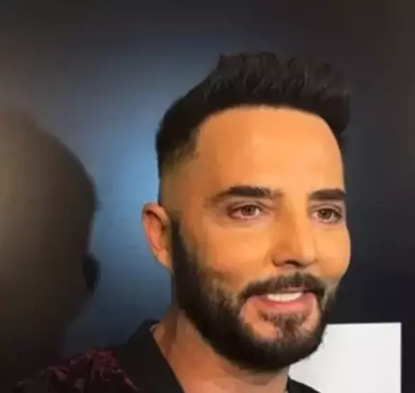 Gökhan Özen Estetik 1