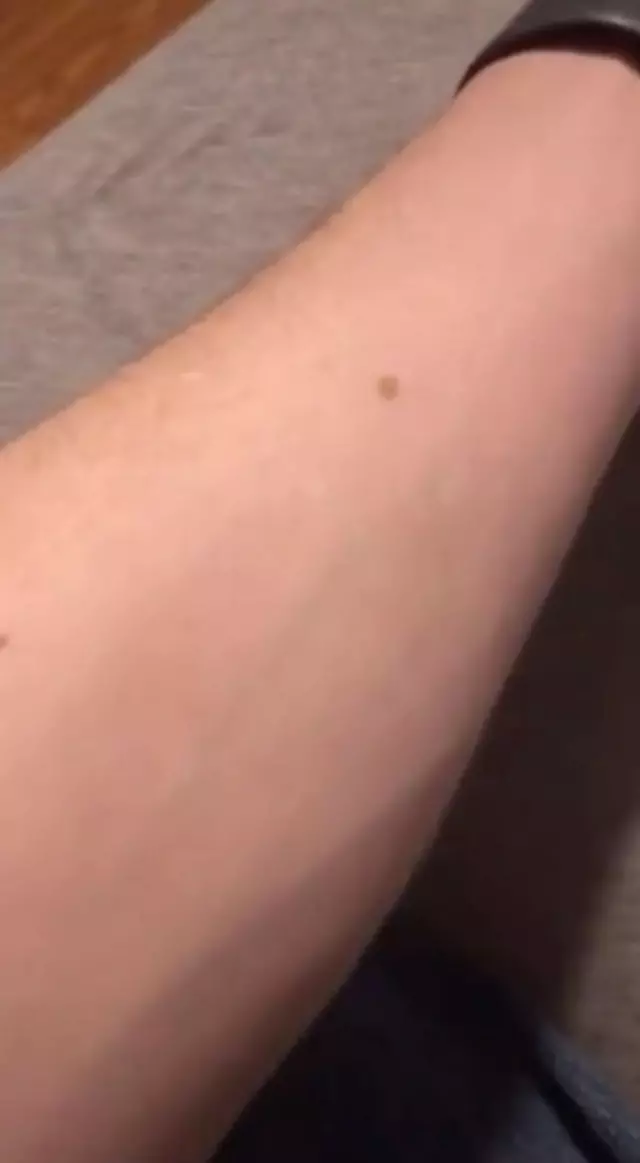 K O L